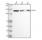 Anti-NEDD4-2 NEDD4L Rabbit Monoclonal Antibody