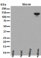 Anti-NEDD4-2 NEDD4L Rabbit Monoclonal Antibody