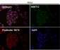 Anti-p95/NBS1 NBN Rabbit Monoclonal Antibody