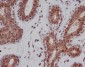 Anti-DNA-PKcs PRKDC Rabbit Monoclonal Antibody