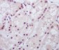 Anti-MAD2L1BP/Mad2L1 Binding Protein Rabbit Monoclonal Antibody