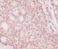 Anti-eIF4EBP1/4Ebp1 Rabbit Monoclonal Antibody