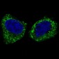 Anti-IKK beta IKBKB Rabbit Monoclonal Antibody