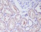 Anti-IKK beta IKBKB Rabbit Monoclonal Antibody