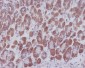 Anti-IKB alpha NFKBIA Rabbit Monoclonal Antibody