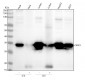 Anti-Caspase-3 CASP3 Rabbit Monoclonal Antibody