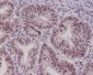 Anti-Pygopus 2 Rabbit Monoclonal Antibody