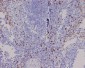Anti-CD8 alpha Rabbit Monoclonal Antibody