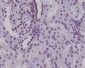 Anti-Lamin A/C LMNA Rabbit Monoclonal Antibody