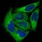 Anti-PKC alpha PRKCA Rabbit Monoclonal Antibody