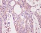 Anti-PKC alpha PRKCA Rabbit Monoclonal Antibody