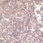 Anti-PKC alpha PRKCA Rabbit Monoclonal Antibody