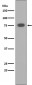 Anti-PKC alpha PRKCA Rabbit Monoclonal Antibody