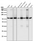 Anti-PKC alpha PRKCA Rabbit Monoclonal Antibody