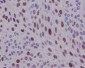 Anti-Cyclin D1 CCND1 Rabbit Monoclonal Antibody