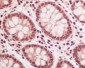 Anti-Ubiquitin UBB Rabbit Monoclonal Antibody