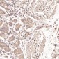 Anti-Ubiquitin UBB Rabbit Monoclonal Antibody