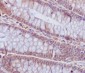Anti-Caspase-6 CASP6 Rabbit Monoclonal Antibody