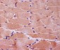 Anti-Myoglobin MB Rabbit Monoclonal Antibody