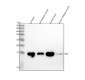 Anti-Myoglobin MB Rabbit Monoclonal Antibody
