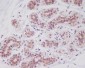 Anti-Cortactin CTTN Rabbit Monoclonal Antibody
