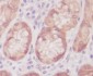 Anti-Caspase-6 CASP6 Rabbit Monoclonal Antibody