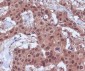Anti-Ubiquitin UBB Rabbit Monoclonal Antibody
