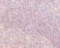 Anti-Human IgM IGHM Rabbit Monoclonal Antibody