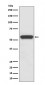 Anti-Aromatase CYP19A1 Rabbit Monoclonal Antibody
