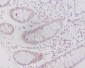 Anti-Caveolin-2 CAV2 Rabbit Monoclonal Antibody