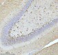 Anti-Stathmin 1 STMN1 Rabbit Monoclonal Antibody