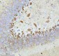 Anti-Stathmin 1 STMN1 Rabbit Monoclonal Antibody
