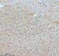 Anti-Stathmin 1 STMN1 Rabbit Monoclonal Antibody