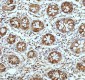 Anti-Stathmin 1 STMN1 Rabbit Monoclonal Antibody