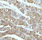 Anti-Stathmin 1 STMN1 Rabbit Monoclonal Antibody