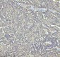 Anti-Stathmin 1 STMN1 Rabbit Monoclonal Antibody