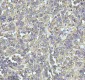 Anti-Stathmin 1 STMN1 Rabbit Monoclonal Antibody