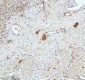 Anti-Stathmin 1 STMN1 Rabbit Monoclonal Antibody