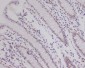Anti-HIF-1 beta ARNT Rabbit Monoclonal Antibody