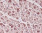 Anti-Troponin I Rabbit Monoclonal Antibody