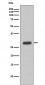 Anti-Troponin I Rabbit Monoclonal Antibody