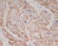 Anti-Troponin T TNNT2 Rabbit Monoclonal Antibody