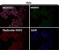 Anti-Syndecan 1 SDC1 Rabbit Monoclonal Antibody