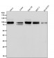 Anti-Aconitase 1 ACO1 Rabbit Monoclonal Antibody