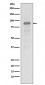 Anti-Hsp90 alpha HSP90AA1 Rabbit Monoclonal Antibody
