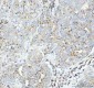 Anti-Flotillin 1 FLOT1 Rabbit Monoclonal Antibody