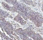 Anti-Flotillin 1 FLOT1 Rabbit Monoclonal Antibody