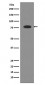 Anti-Transferrin TF Rabbit Monoclonal Antibody