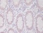 Anti-hnRNP C1/C2 Rabbit Monoclonal Antibody