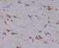Anti-Glutaminase GLS Rabbit Monoclonal Antibody